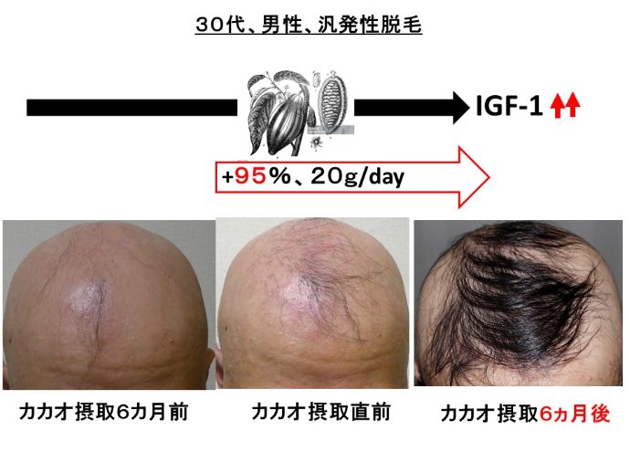 円形脱毛症　病院